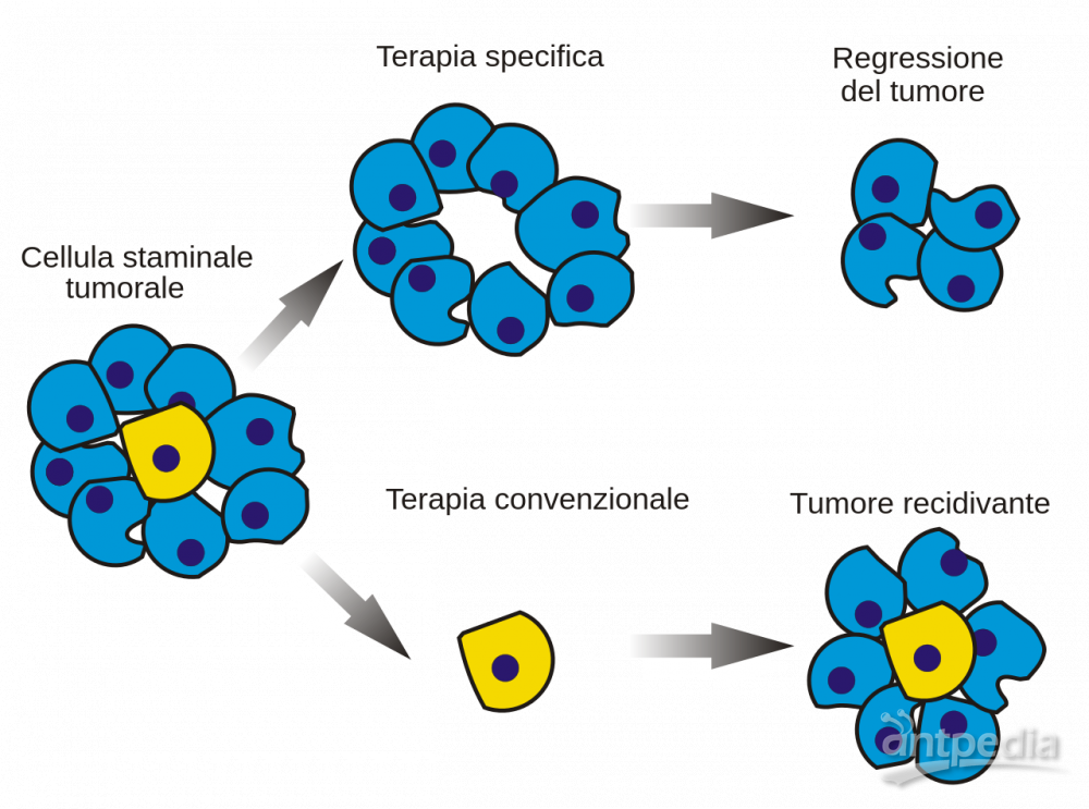 胶质母细胞瘤(图1)