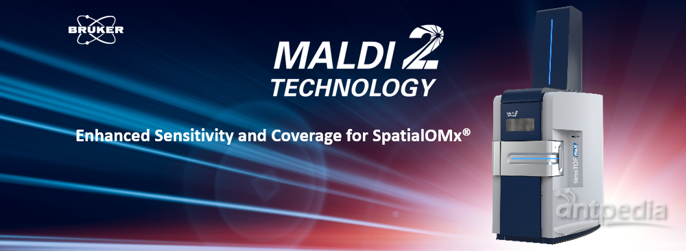 MALDI Guided SpatialOMx on the timsTOF fleX