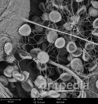 blood-cloth-SEM-image-no-synapse-text.png