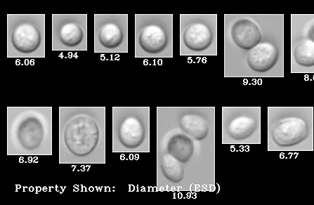 Yeast cells imaged on the FlowCam Nano.jpg